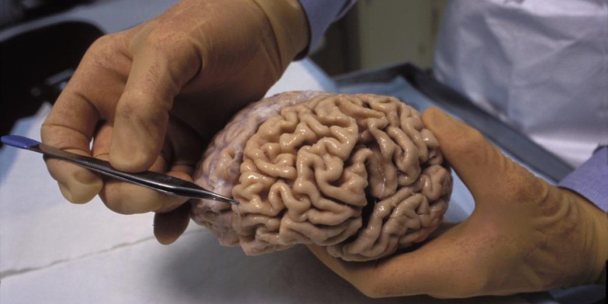 Застенчивость оказалась не просто чертой характера: что обнаружили ученые в мозге скромных людей Застенчивость оказалась не просто чертой характера: что обнаружили ученые в мозге скромных людей