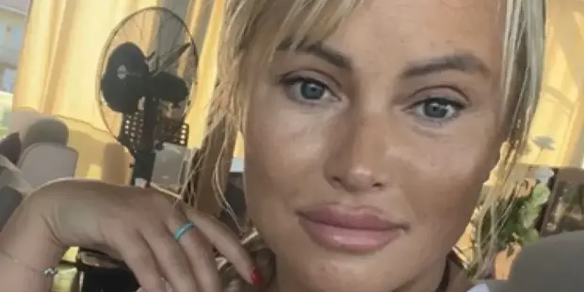 «Чувствую себя старушкой»: Дана Борисова о последствиях новой пластики «Чувствую себя старушкой»: Дана Борисова о последствиях новой пластики