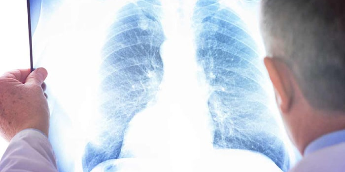 Невидимая угроза или надуманный страх: что скрывают настоящие дозы облучения при рентгене и флюорографии Невидимая угроза или надуманный страх: что скрывают настоящие дозы облучения при рентгене и флюорографии