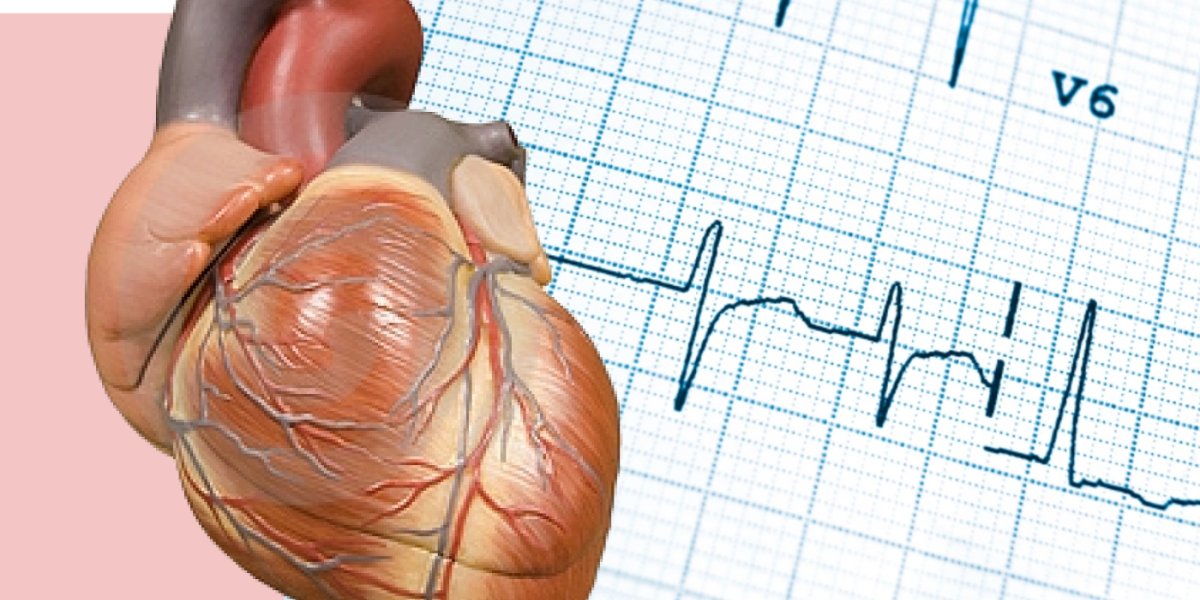 Тревожные сигналы сердца: как распознать приближающийся инфаркт Тревожные сигналы сердца: как распознать приближающийся инфаркт