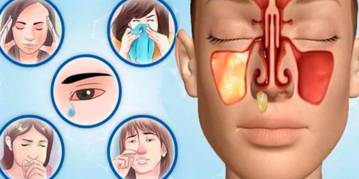 Оториноларинголог предупреждает: самолечение гайморита — это игра с огнем, где на кону стоит ваша жизнь Оториноларинголог предупреждает: самолечение гайморита — это игра с огнем, где на кону стоит ваша жизнь